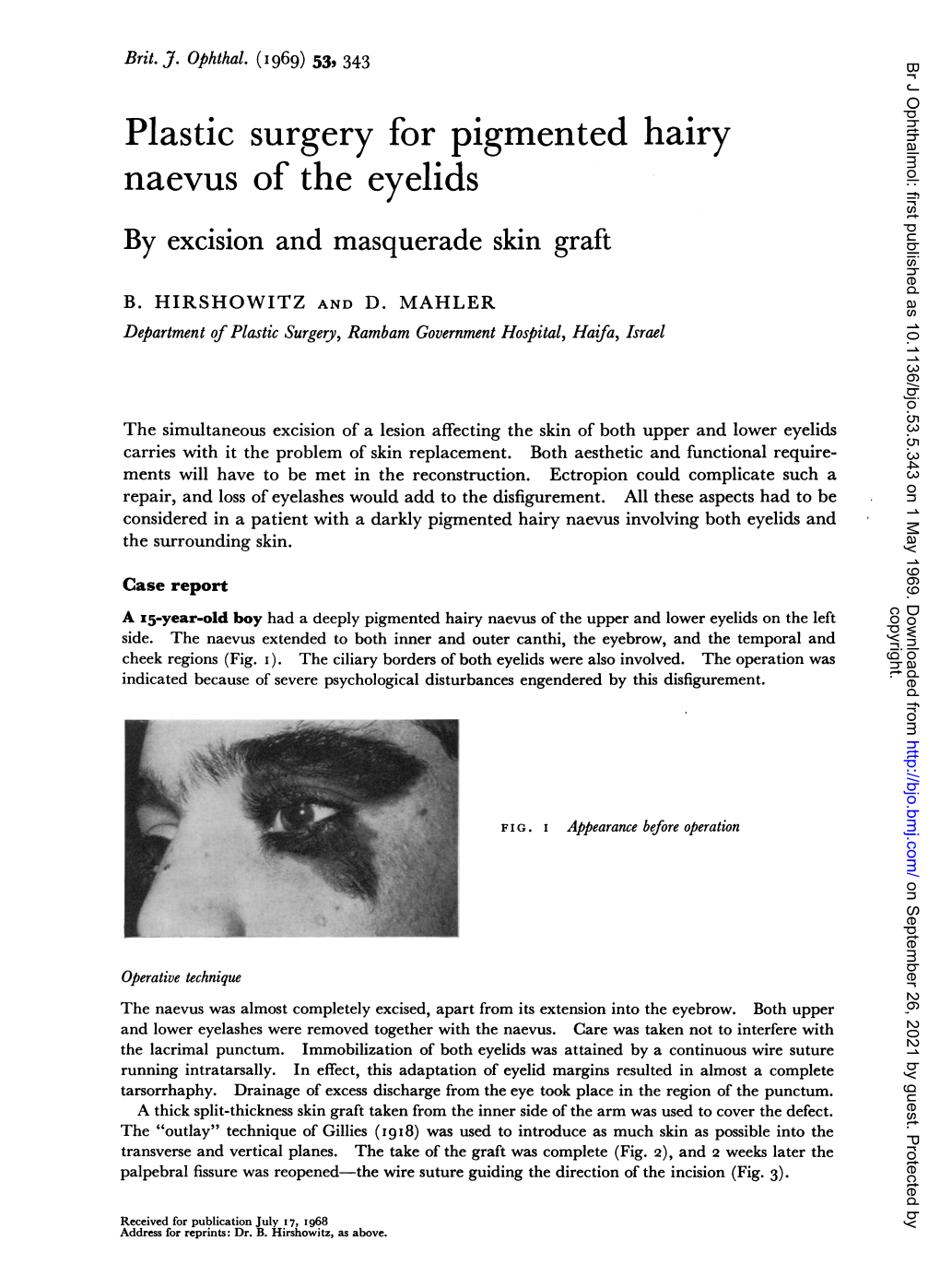 Plastic Surgery for Pigmented Hairy Naevus of the Eyelids by Excision and Masquerade Skin Graft