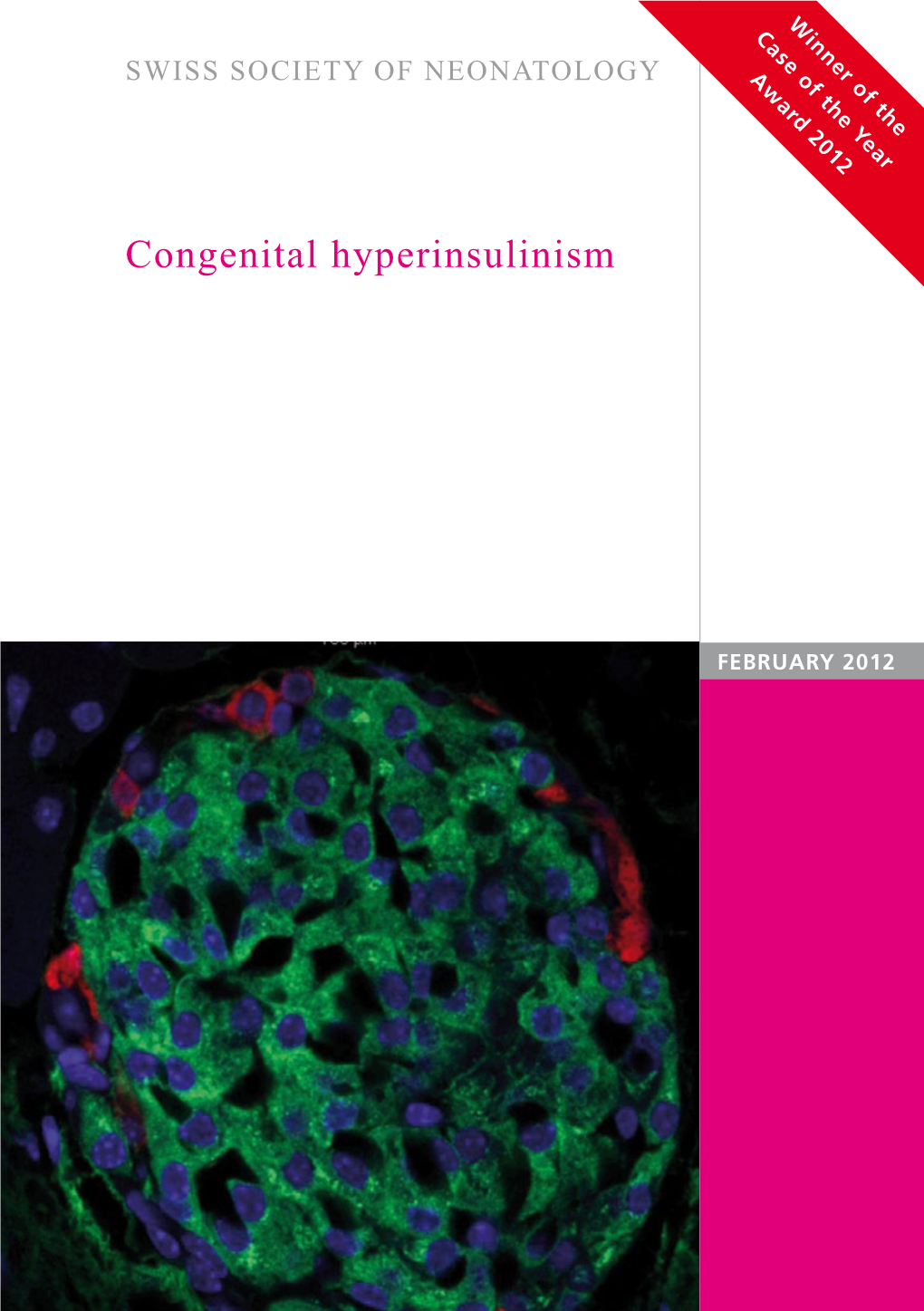 Congenital Hyperinsulinism