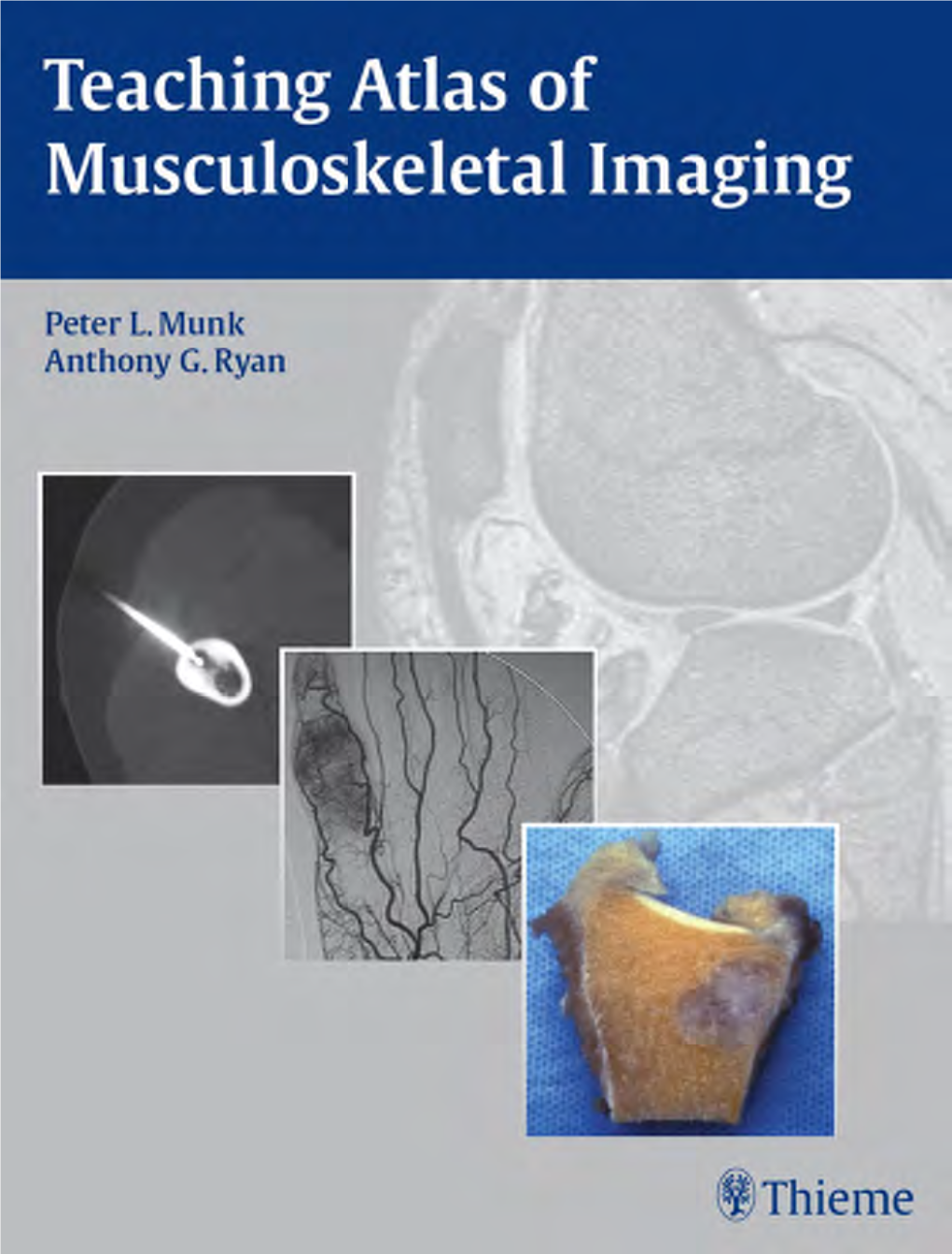 Thieme: Teaching Atlas of Musculoskeletal Imaging