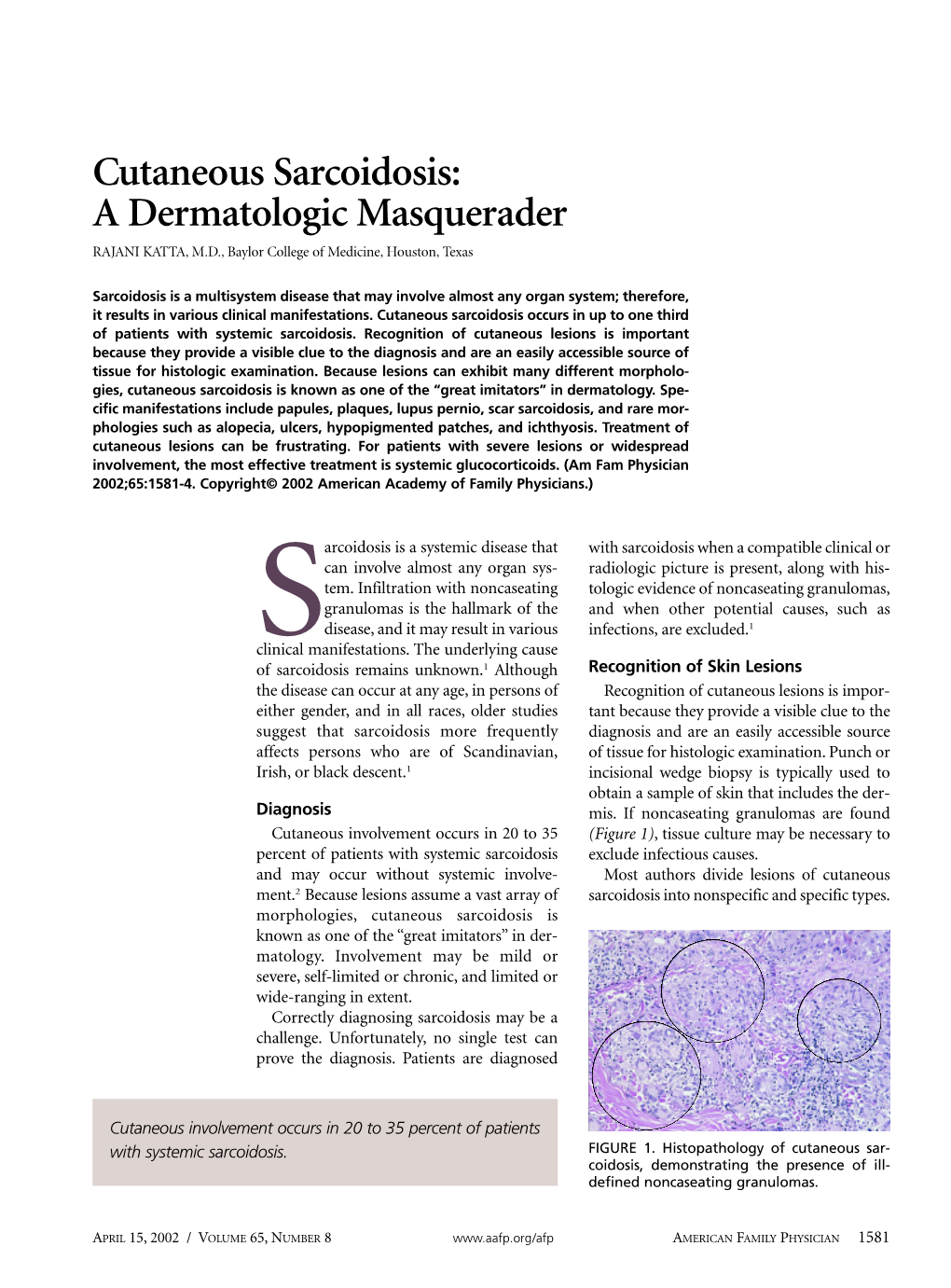 Cutaneous Sarcoidosis: a Dermatologic Masquerader RAJANI KATTA, M.D., Baylor College of Medicine, Houston, Texas