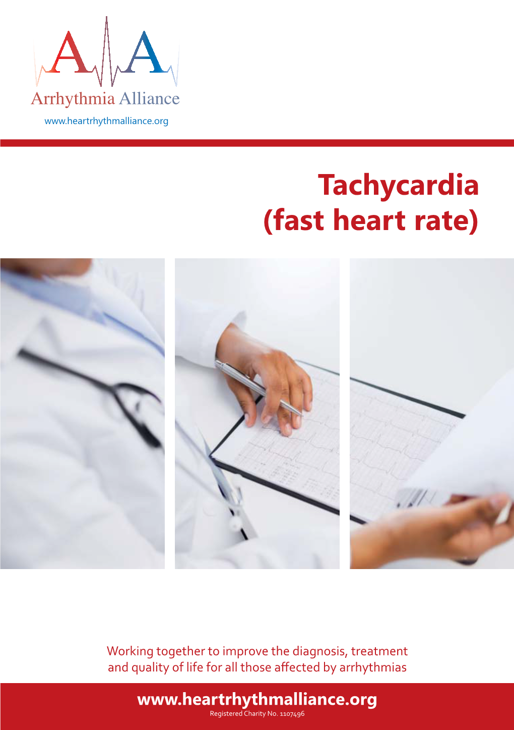 Tachycardia (Fast Heart Rate)