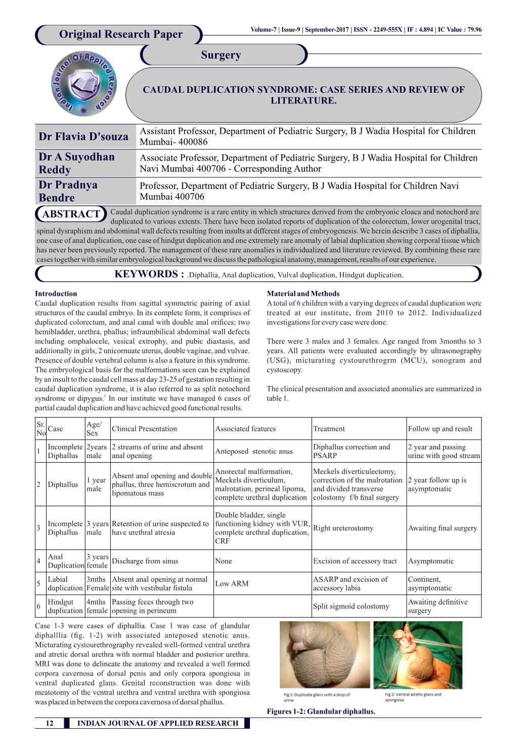 Caudal Duplication Syndrome: Case Series and Review of Literature