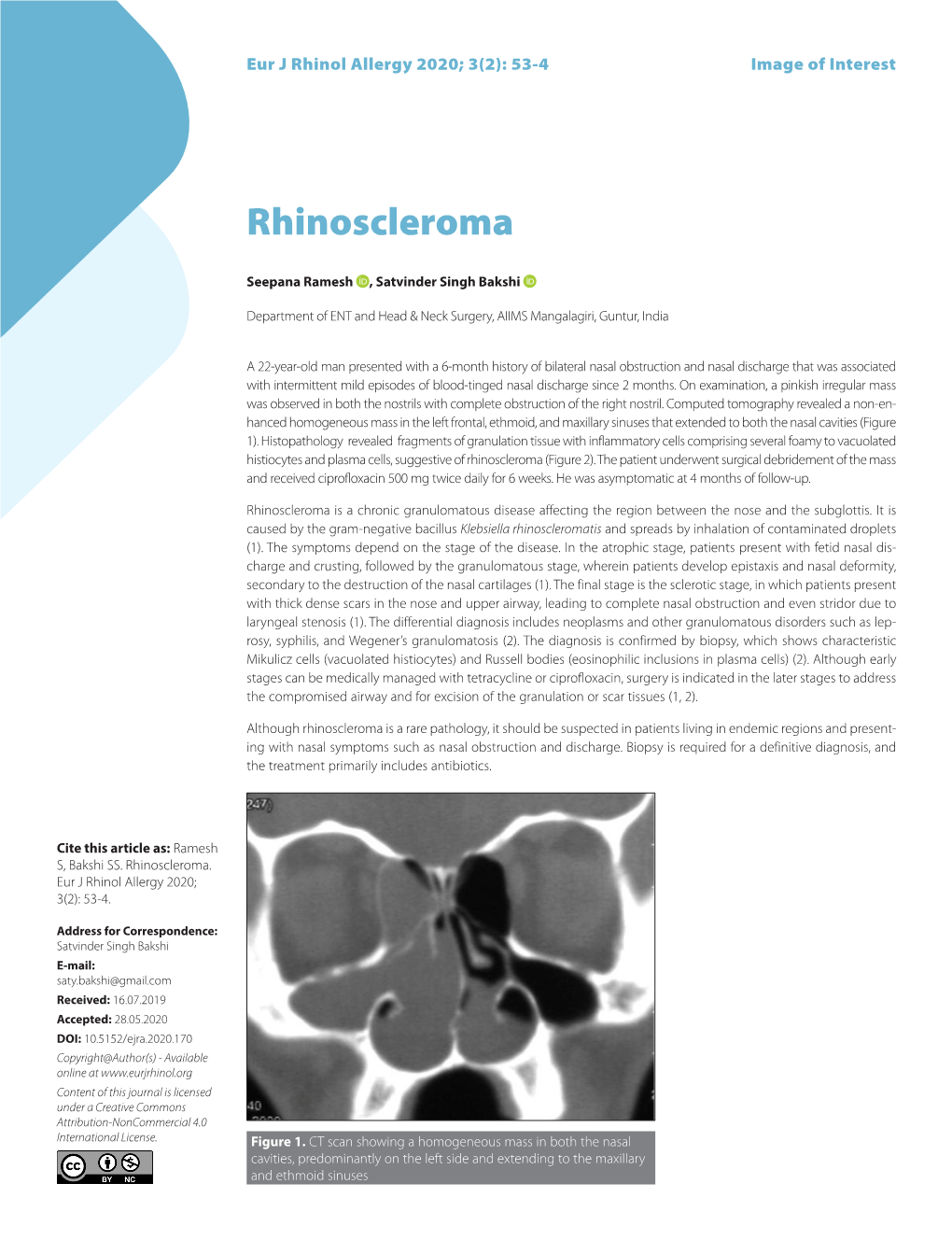 Rhinoscleroma