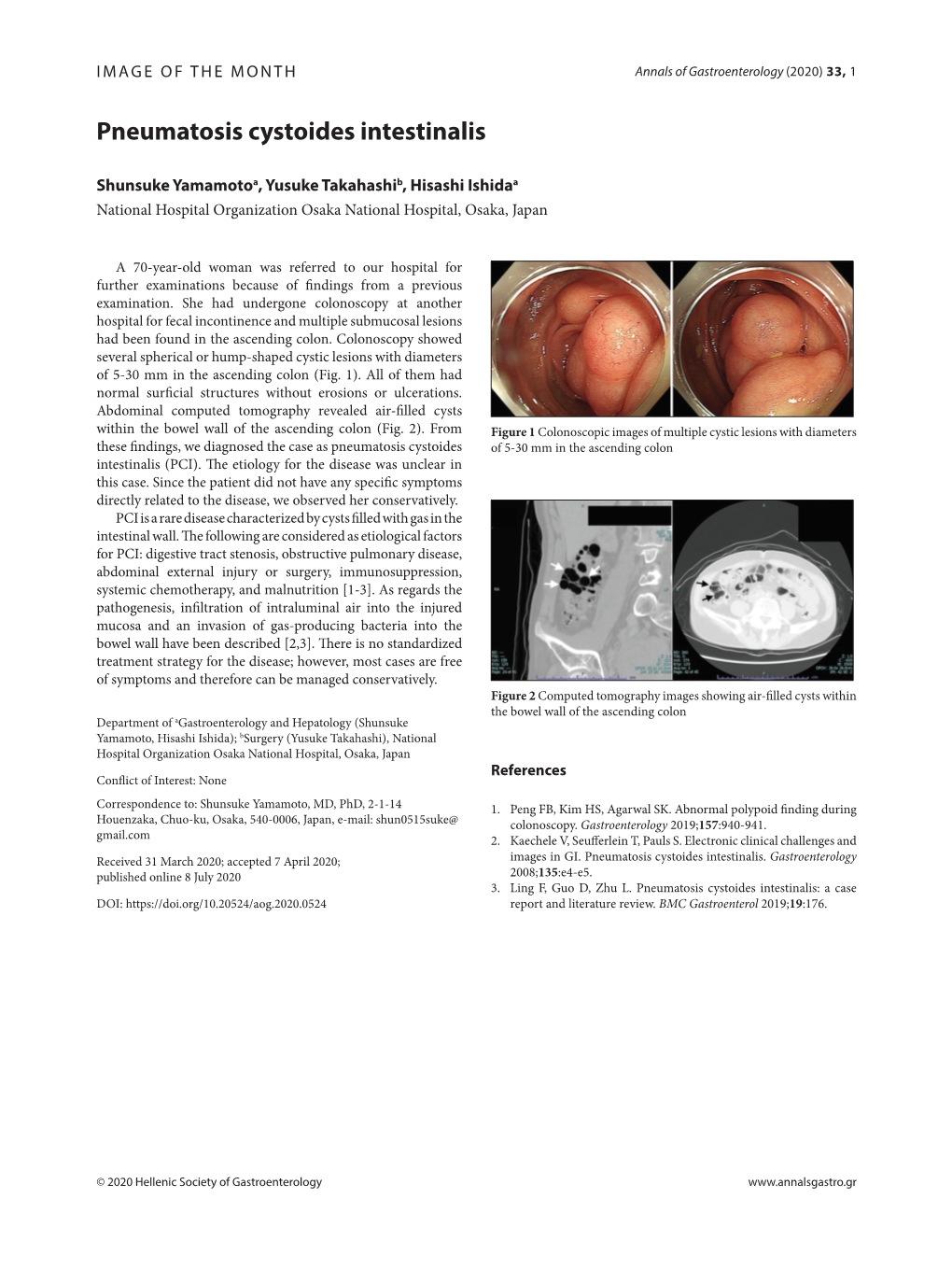 Pneumatosis Cystoides Intestinalis