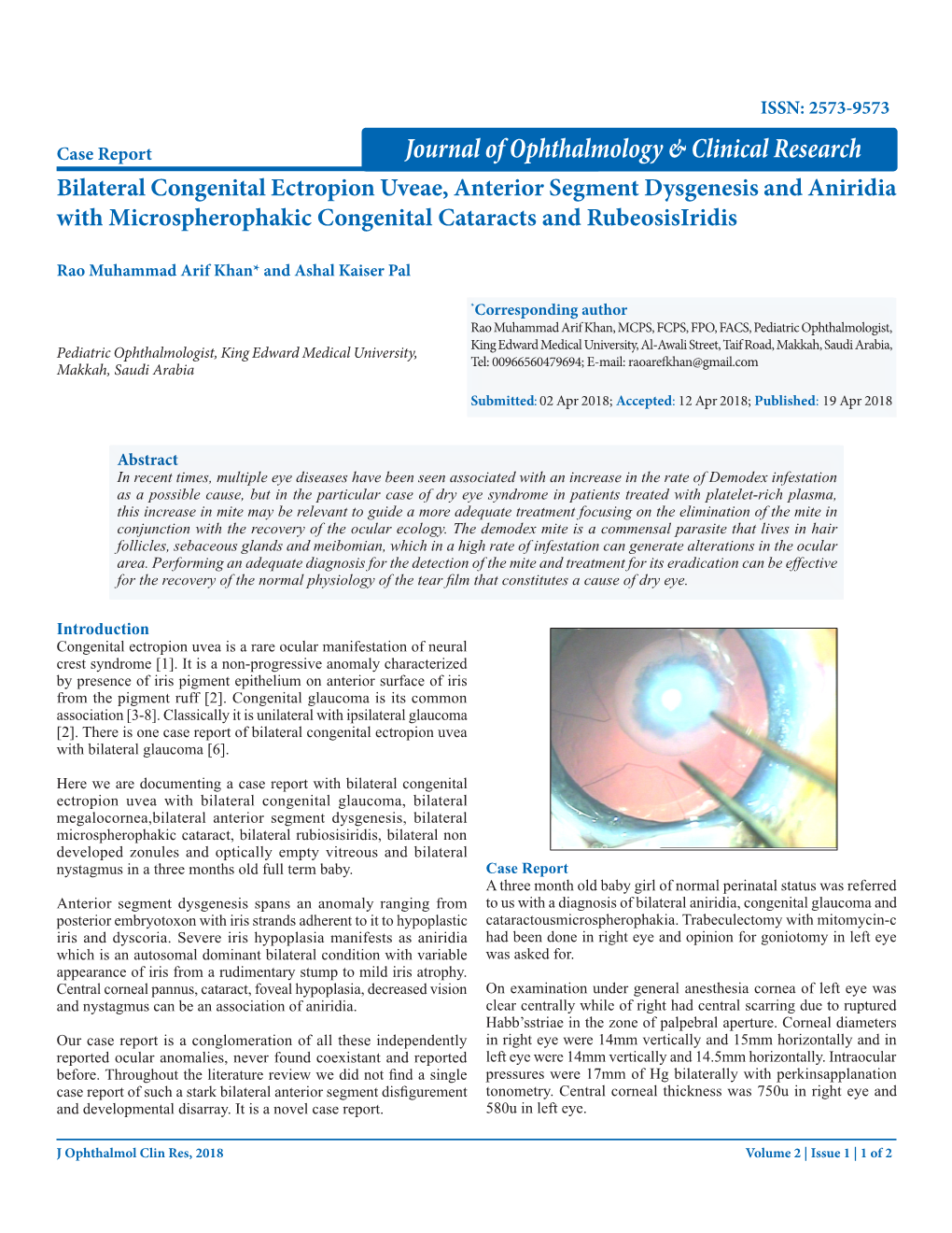 Journal of Ophthalmology & Clinical Research