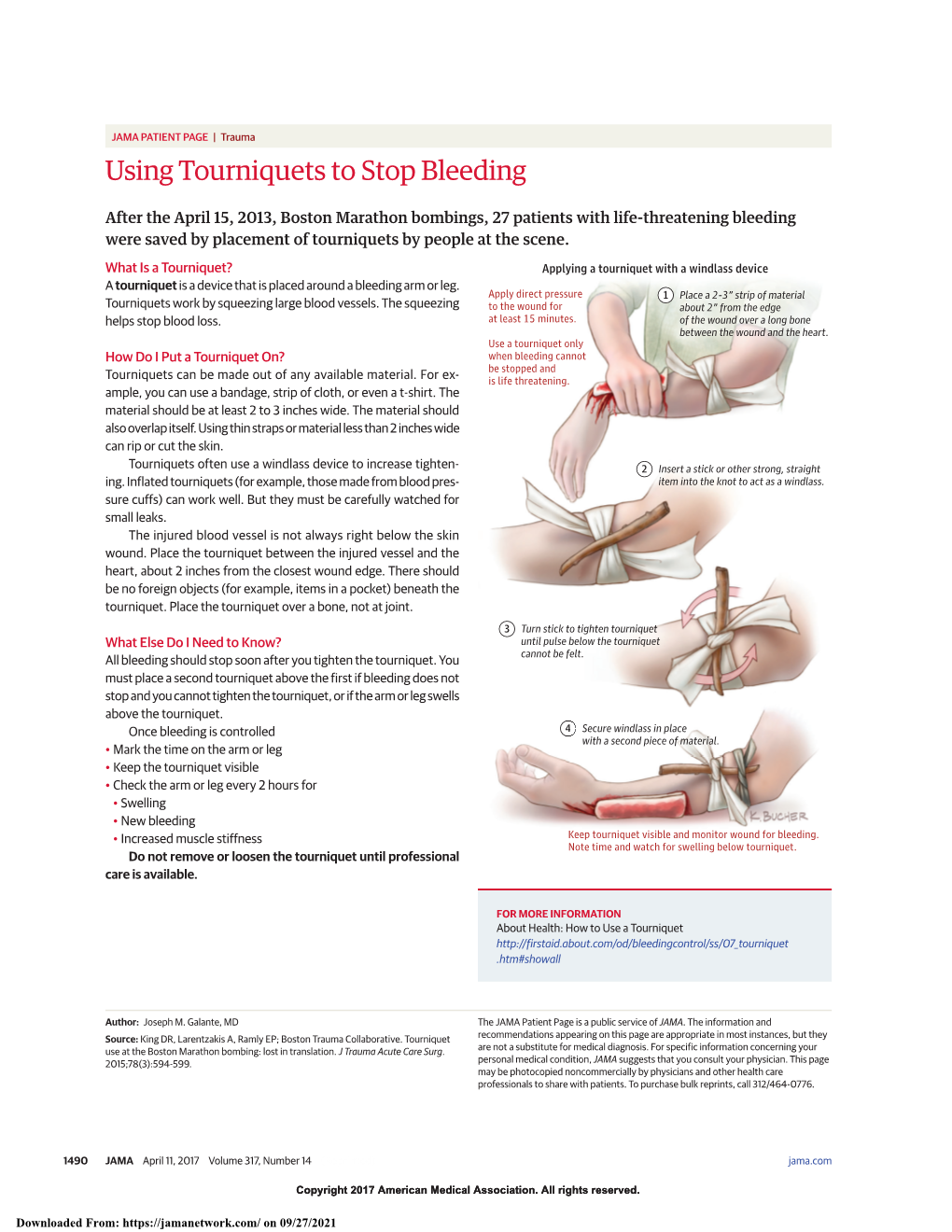 Using Tourniquets to Stop Bleeding