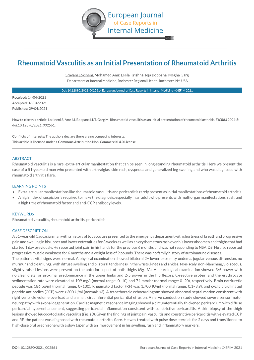 Rheumatoid Vasculitis As an Initial Presentation of Rheumatoid Arthritis