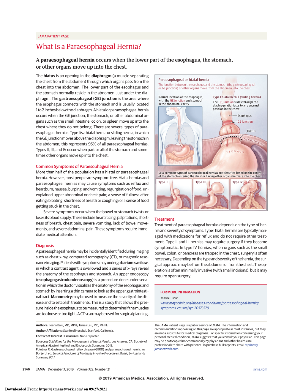 What Is a Paraesophageal Hernia?