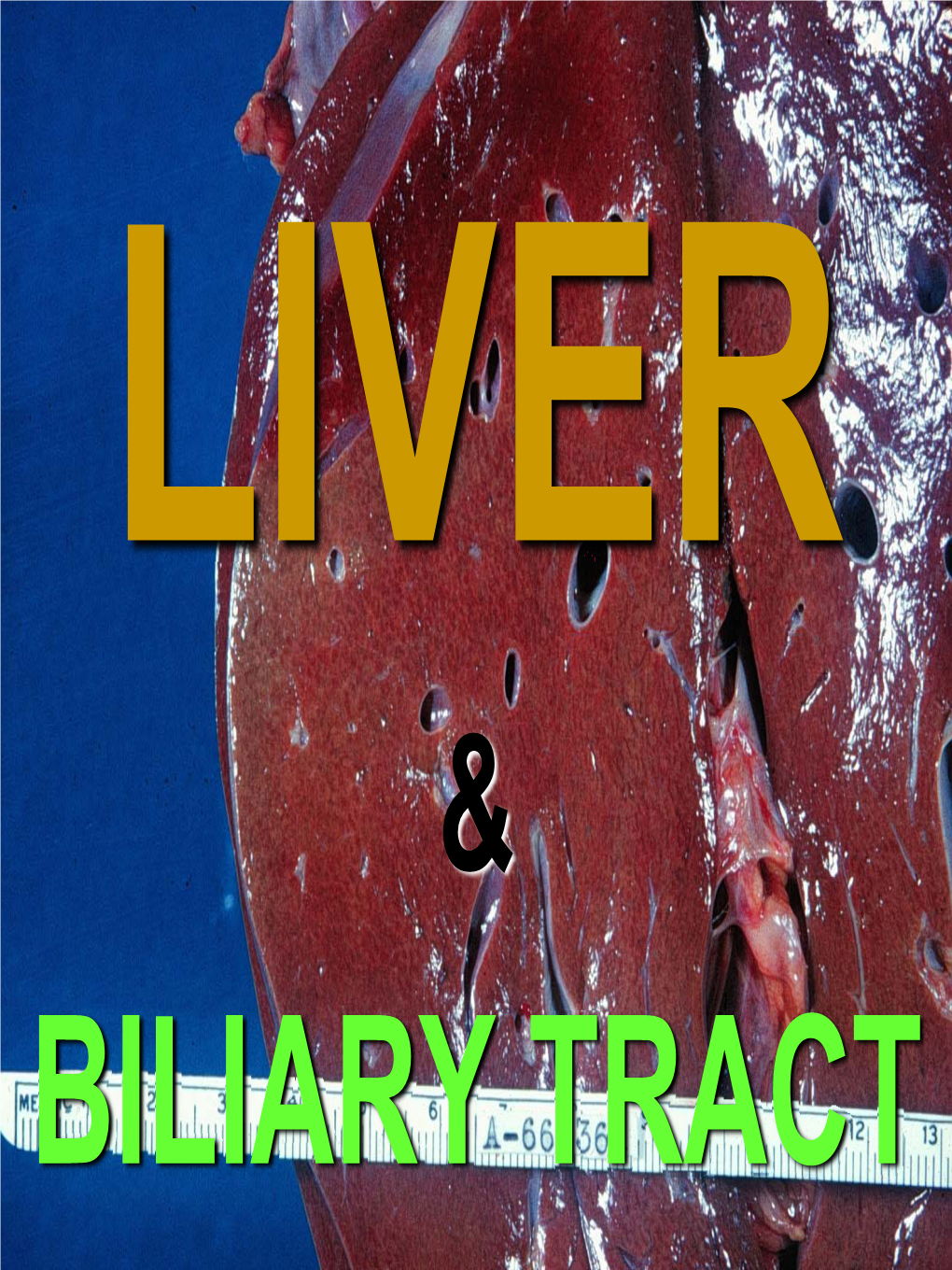 LIVER “MICRO”-VESICULAR STEATOSIS Obesity Diabetes Toxic