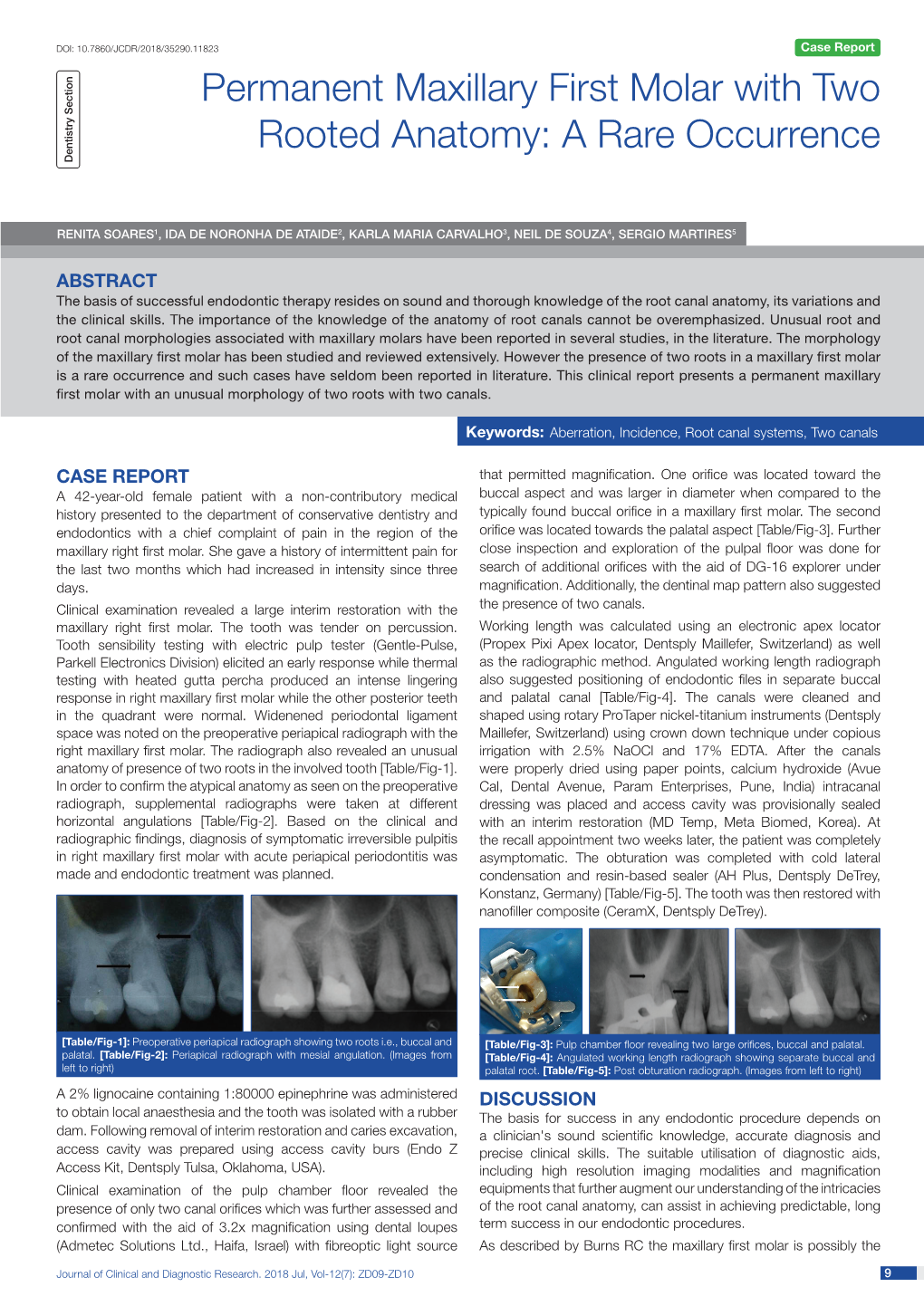 Permanent Maxillary First Molar with Two Rooted Anatomy: a Rare Occurrence Dentistry Section
