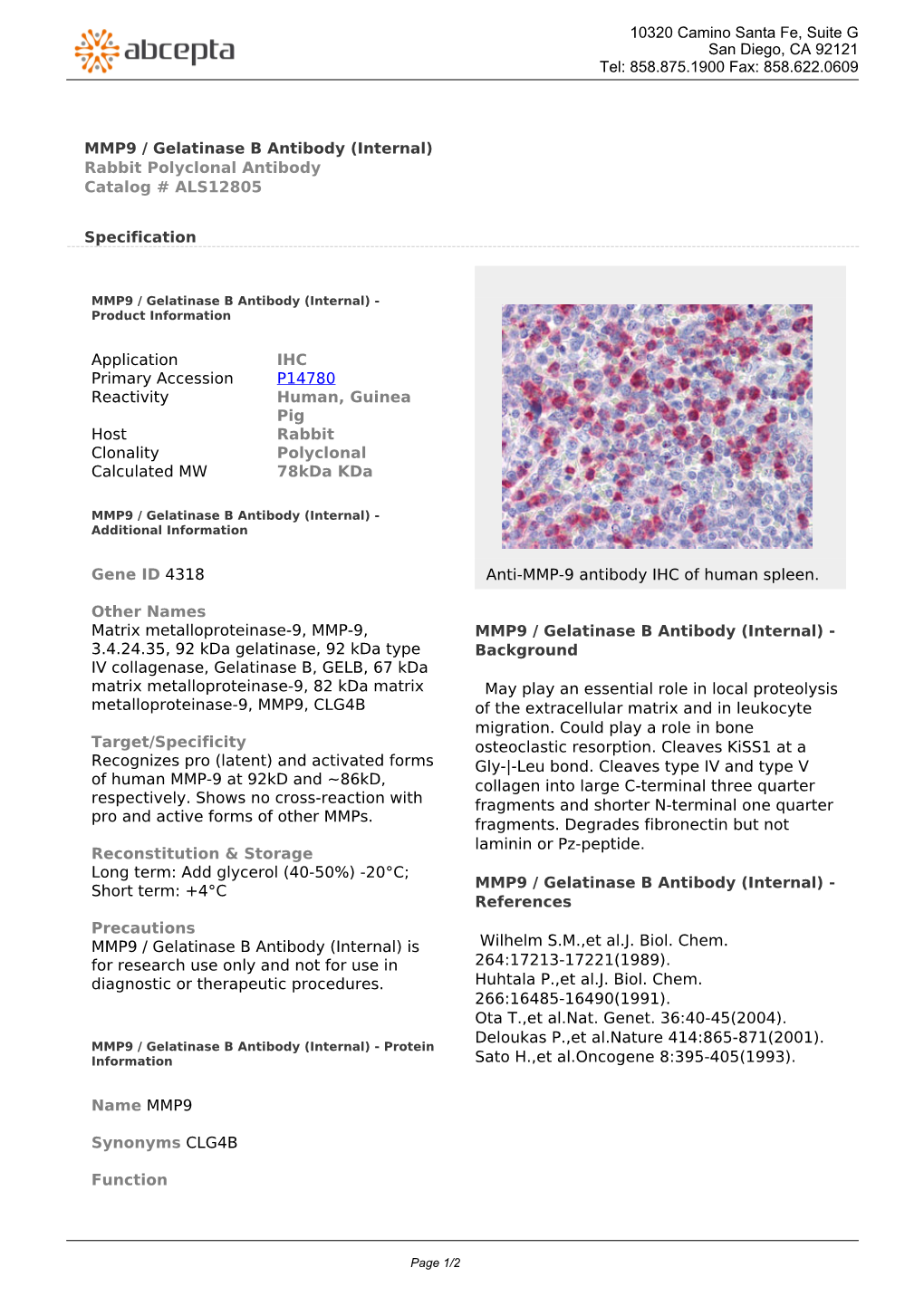 MMP9 / Gelatinase B Antibody (Internal) Rabbit Polyclonal Antibody Catalog # ALS12805
