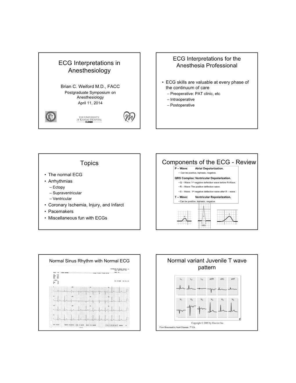 ECG Interpretations in Anesthesiology Topics Components of The
