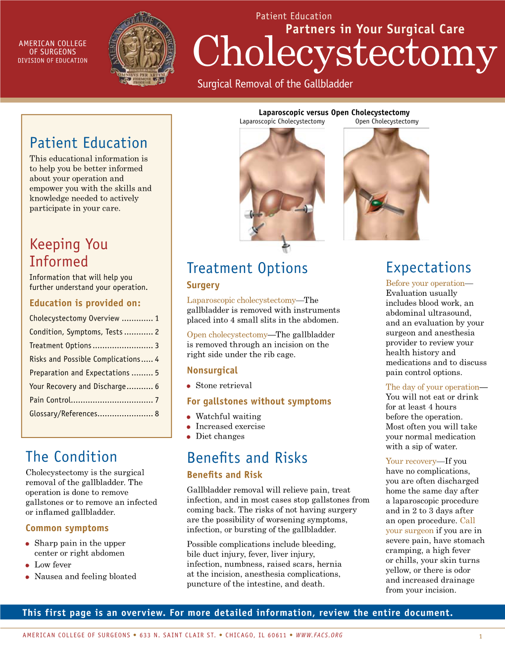 Gallbladder Removal