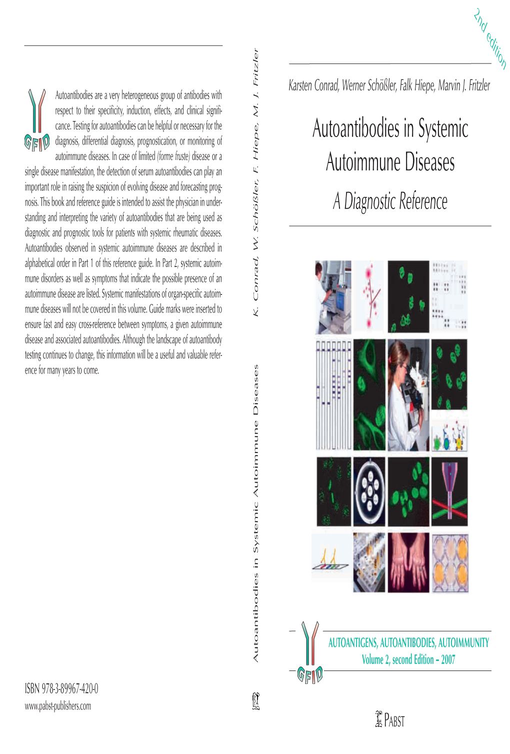 Autoantibodies in Systemic Autoimmune Diseases K