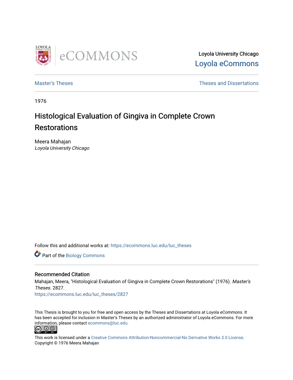 Histological Evaluation of Gingiva in Complete Crown Restorations