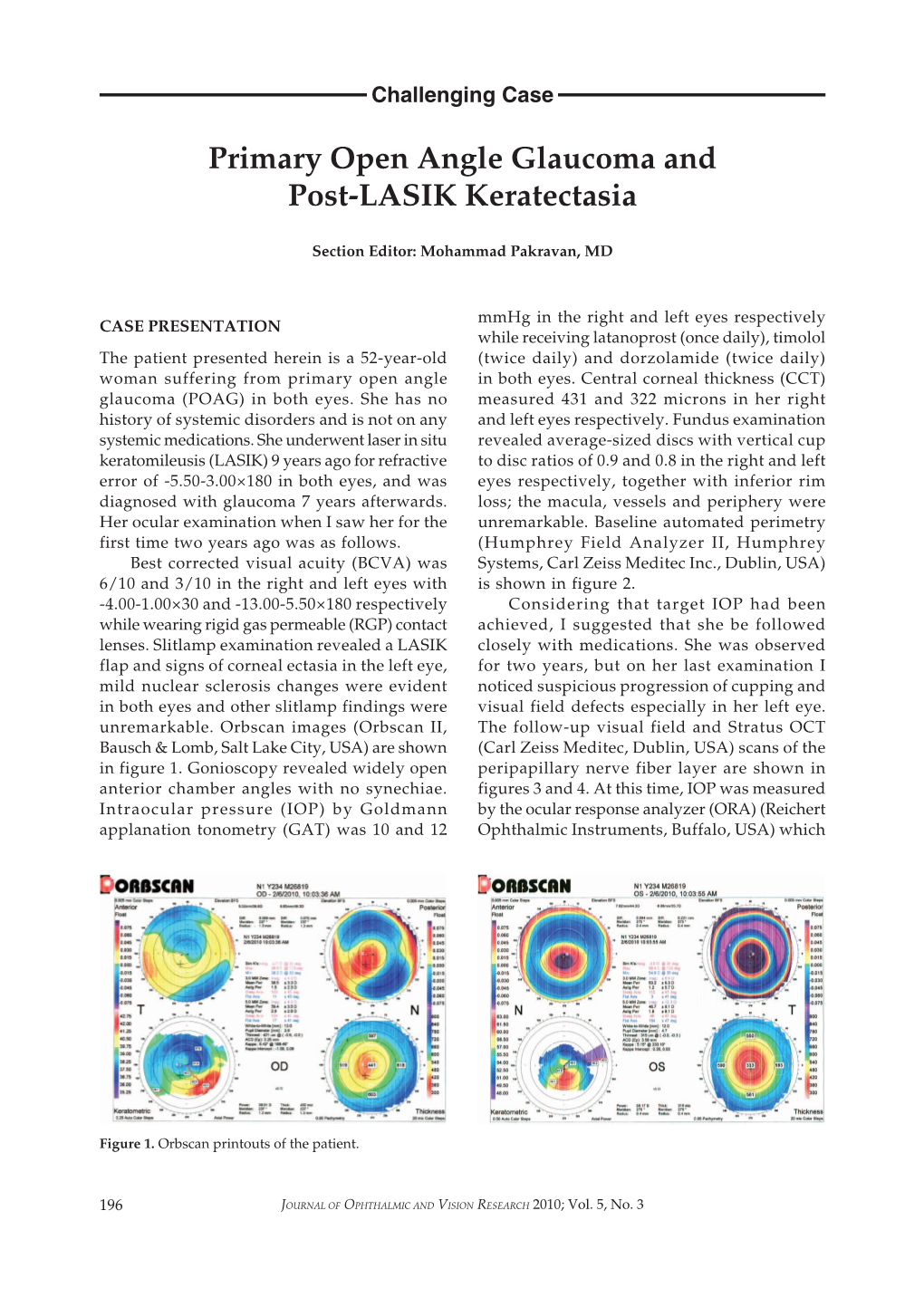 Primary Open Angle Glaucoma and Post-LASIK Keratectasia