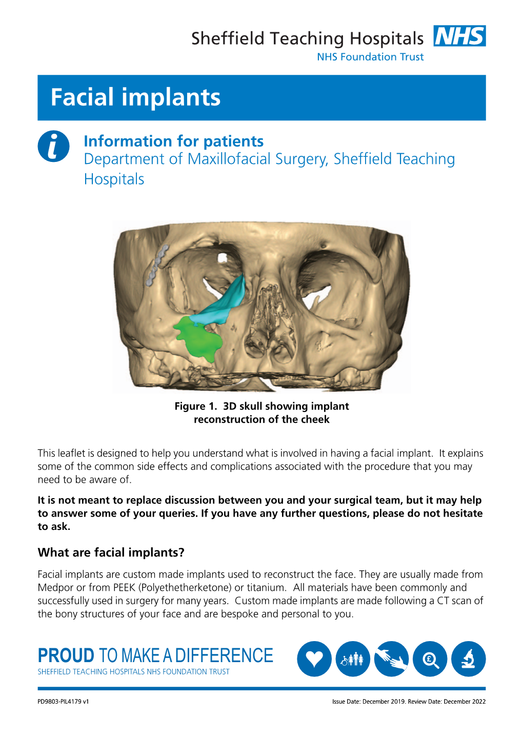 Facial Implants