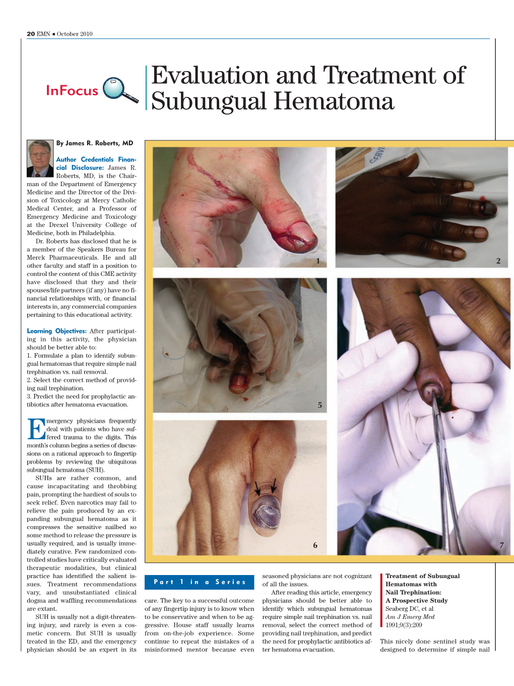 Evaluation and Treatment of Subungual Hematoma