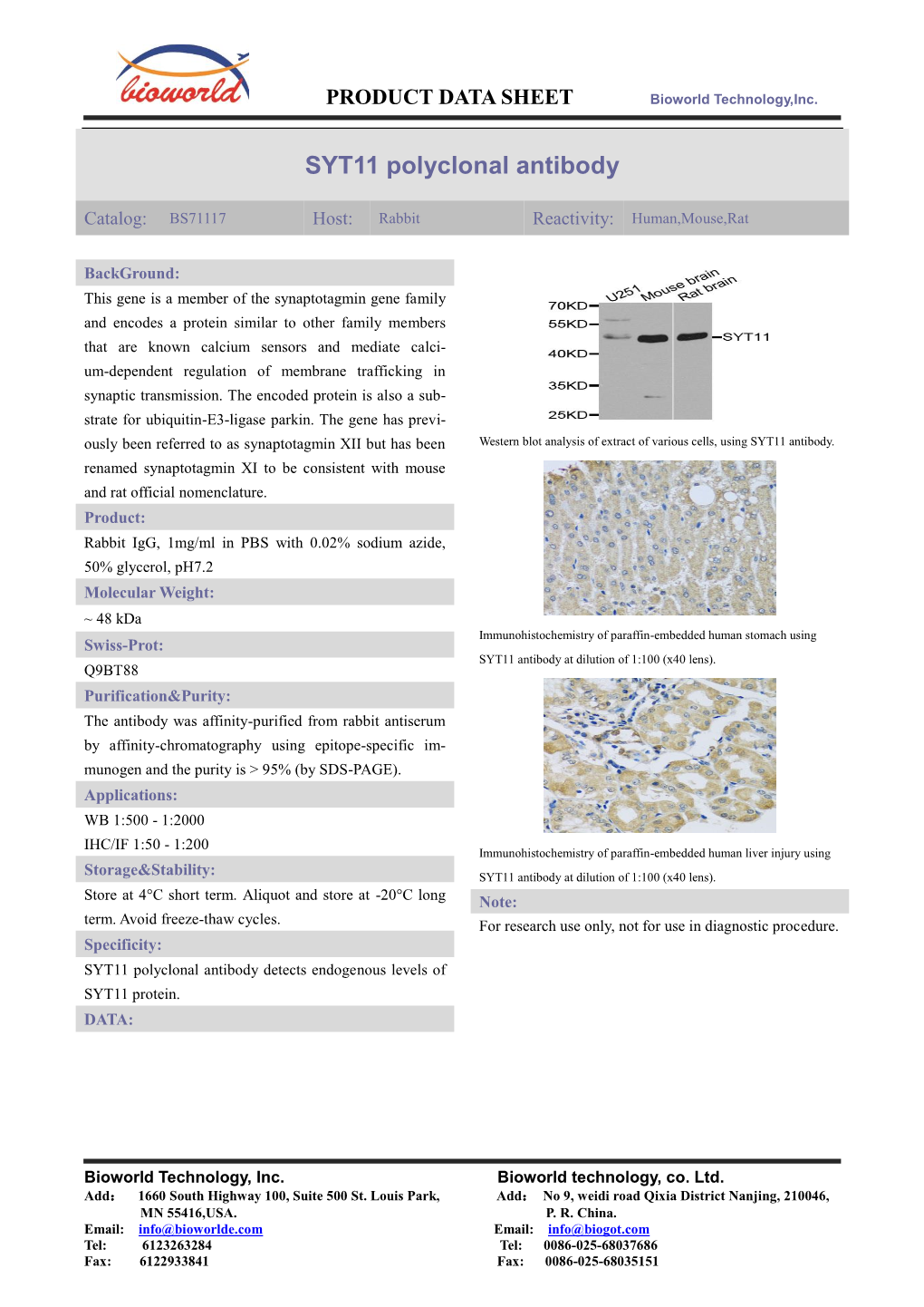 SYT11 Polyclonal Antibody