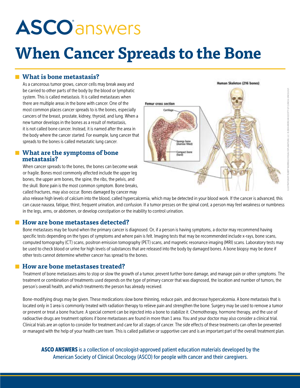 When Cancer Spreads to the Bone