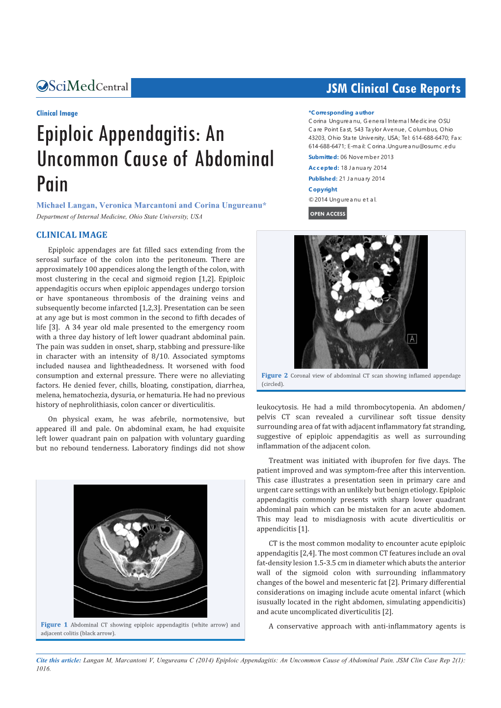 Epiploic Appendagitis