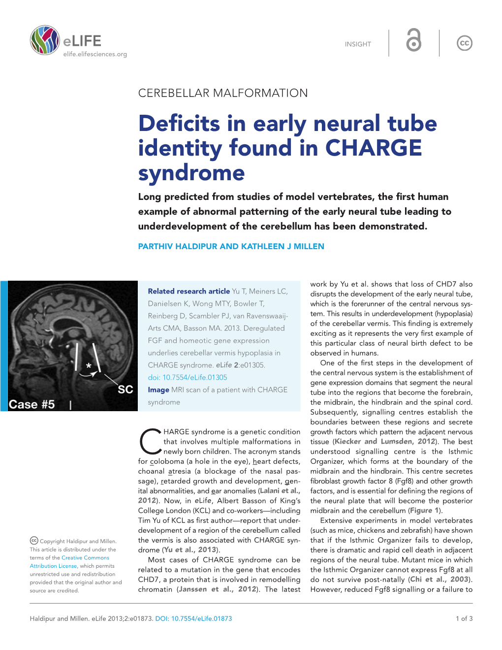 Deficits in Early Neural Tube Identity Found in CHARGE Syndrome