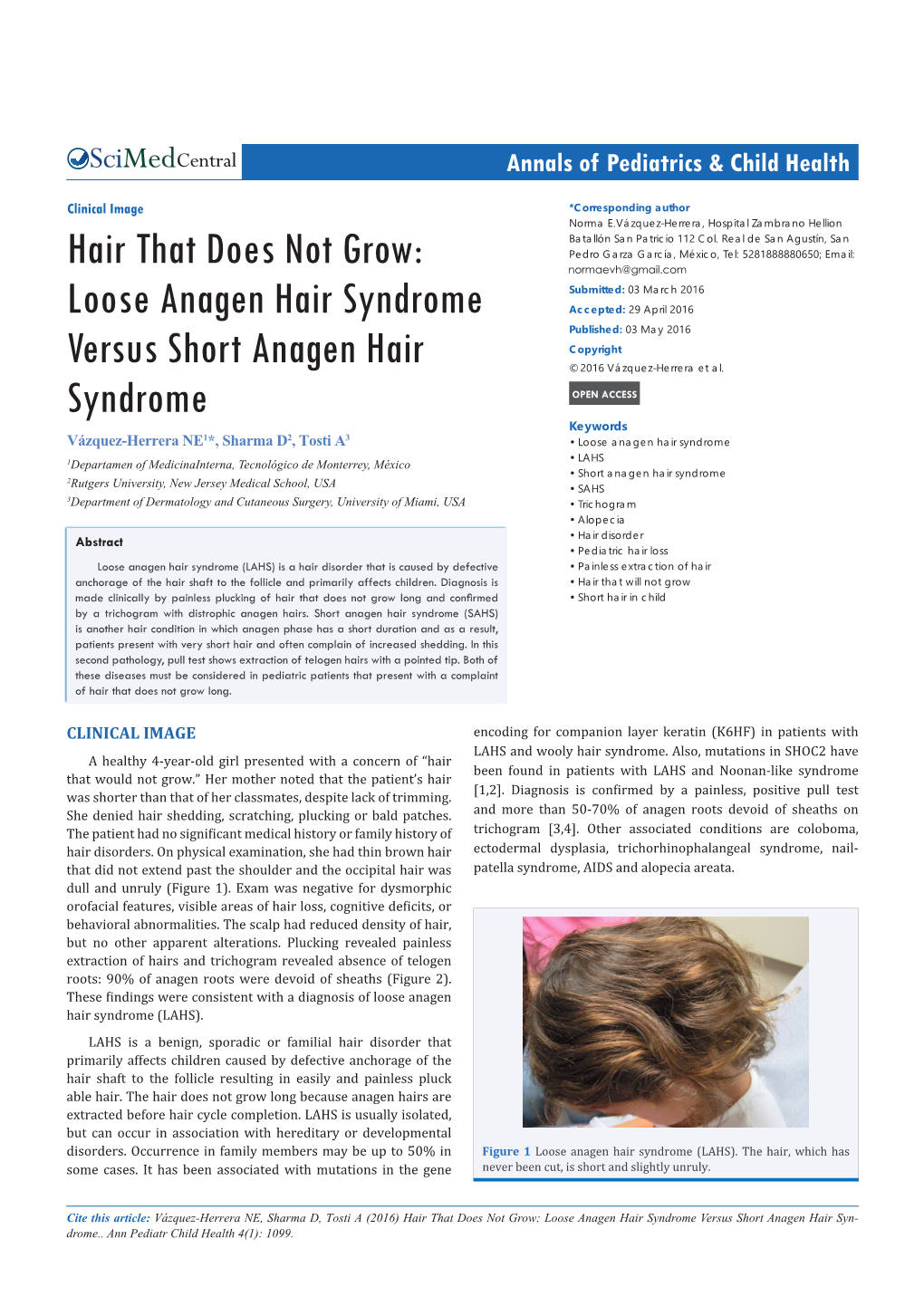 Hair That Does Not Grow: Loose Anagen Hair Syndrome Versus Short Anagen Hair Syndrome