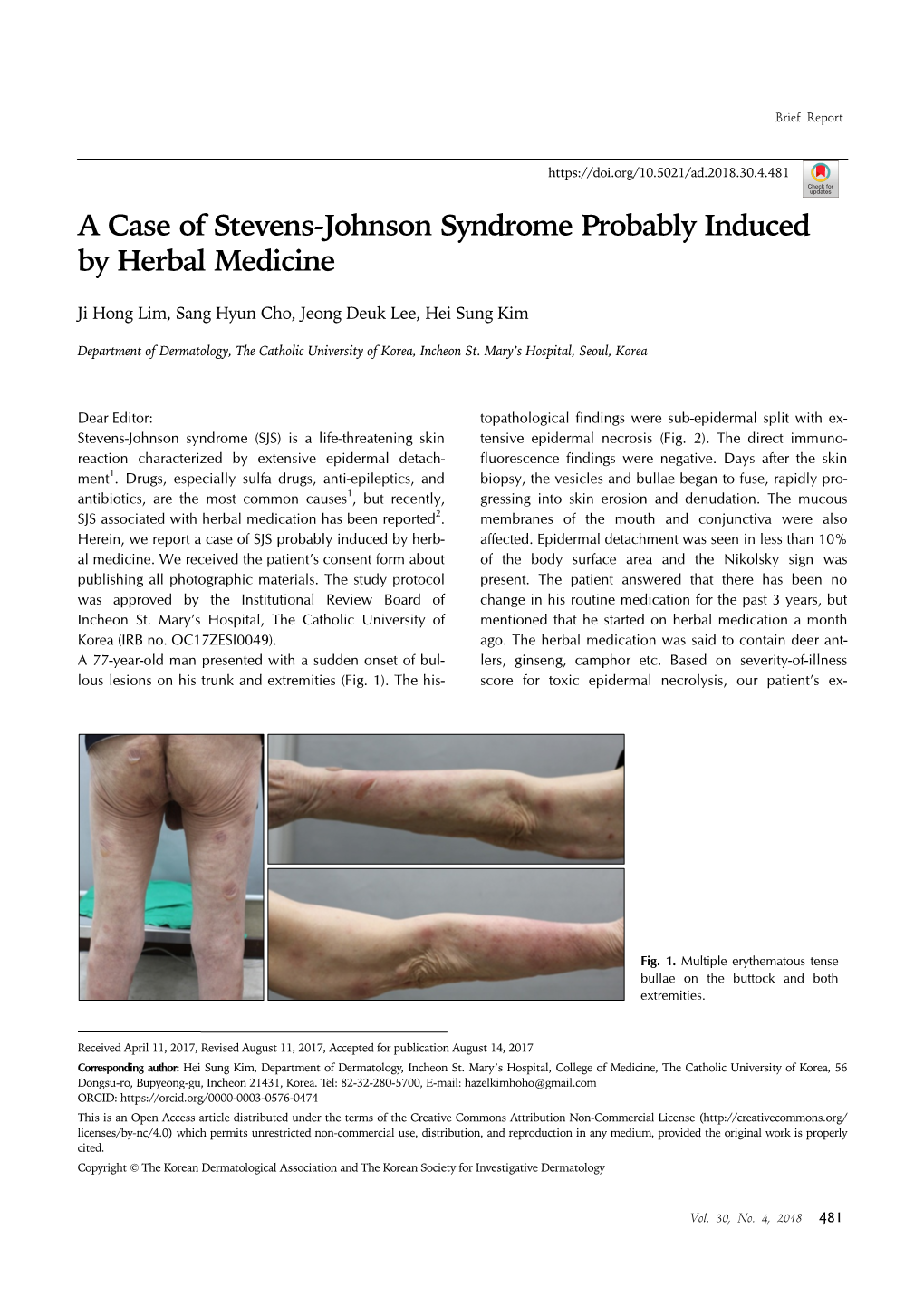 A Case of Stevens-Johnson Syndrome Probably Induced by Herbal Medicine