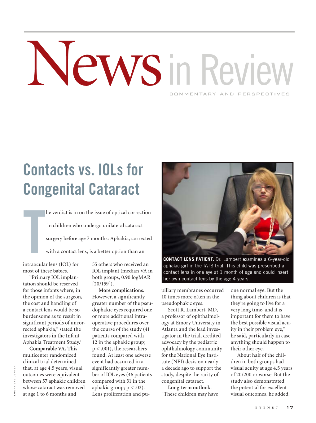 Contacts Vs. Iols for Congenital Cataract