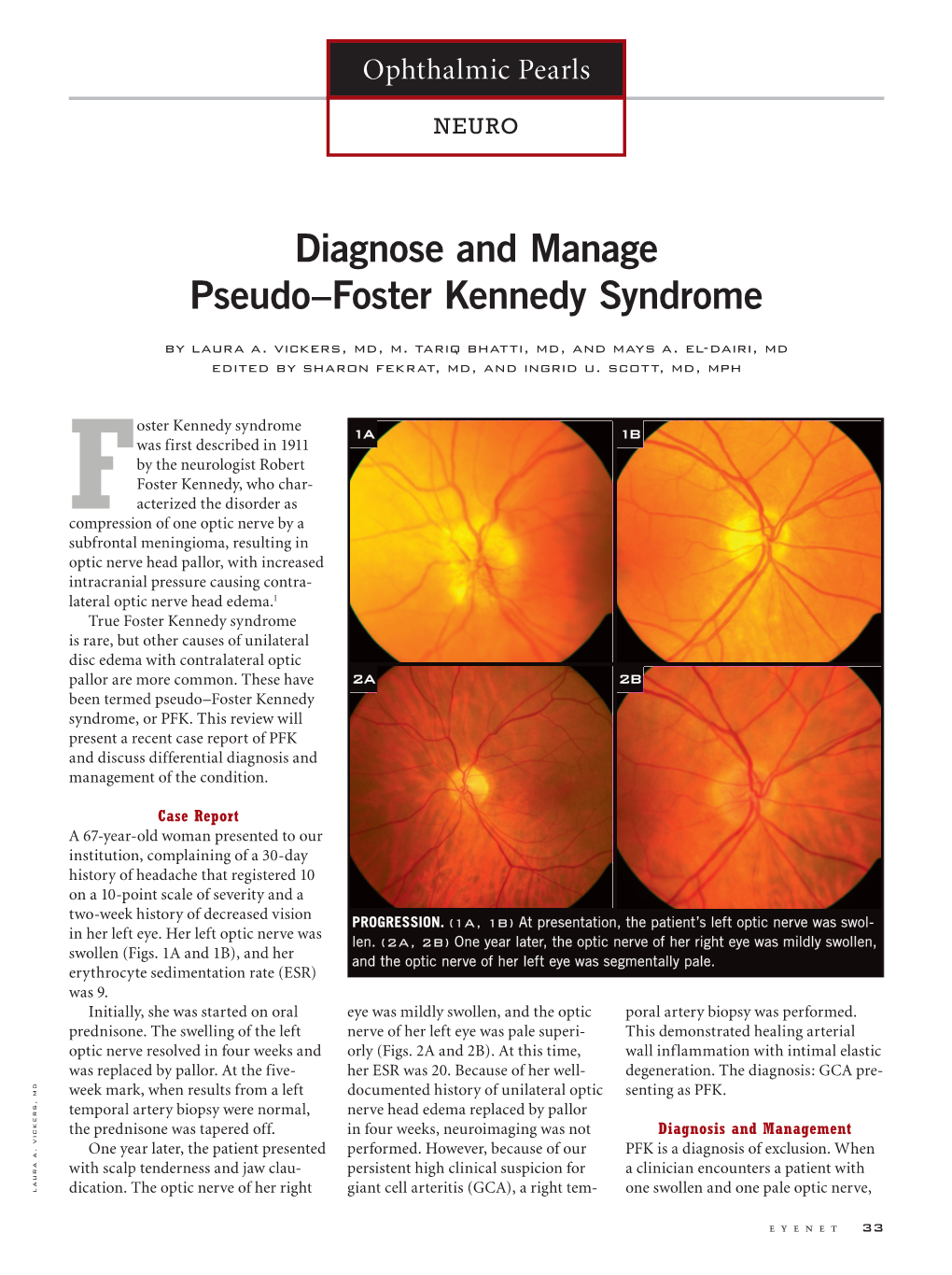 Diagnose and Manage Pseudo–Foster Kennedy Syndrome