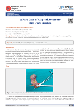 A Rare Case of Atypical Accessory Bile Duct: Luschca