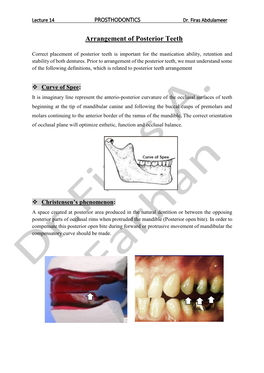 Arrangement of Posterior Teeth
