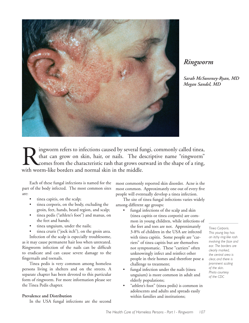 Ringworm Refers To Infections Caused By Several Fungi Commonly Called Docslib 1173