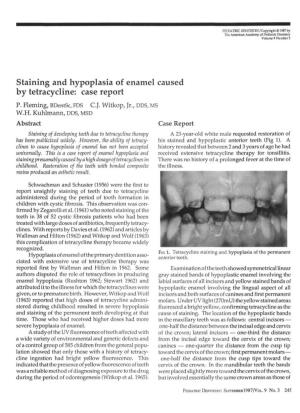Staining and Hypoplasia of Enamel Caused by Tetracycline: Case Report P