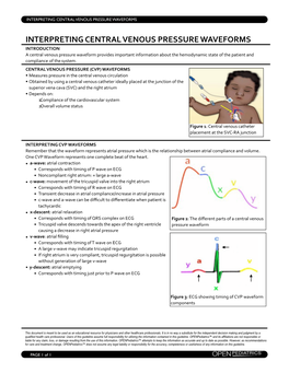 Interpreting CVP Waveforms Summary EK