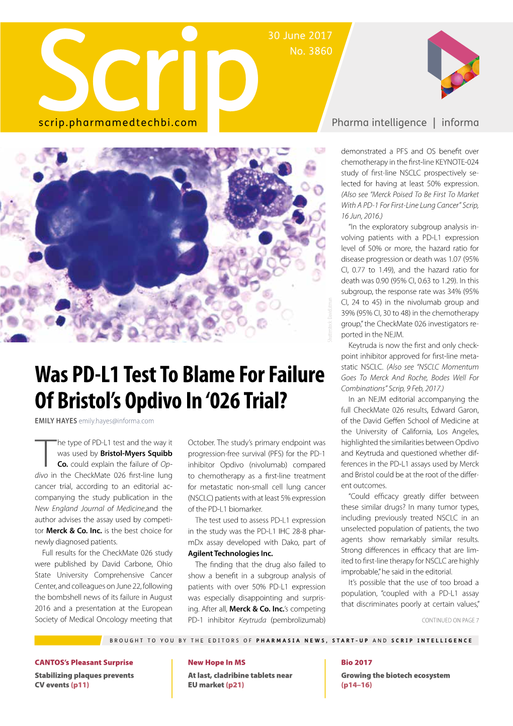 Was PD-L1 Test to Blame for Failure of Bristol's
