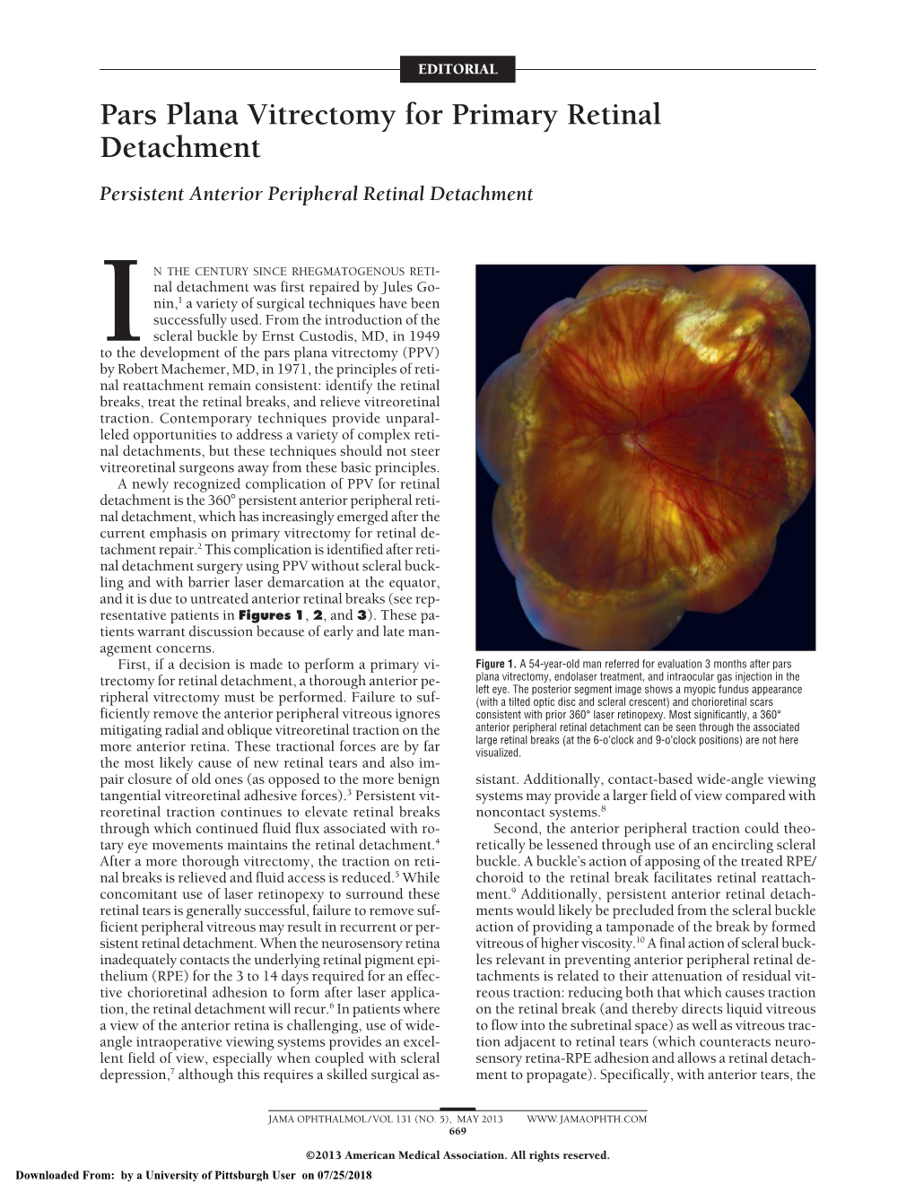 Pars Plana Vitrectomy For Primary Retinal Detachment Persistent