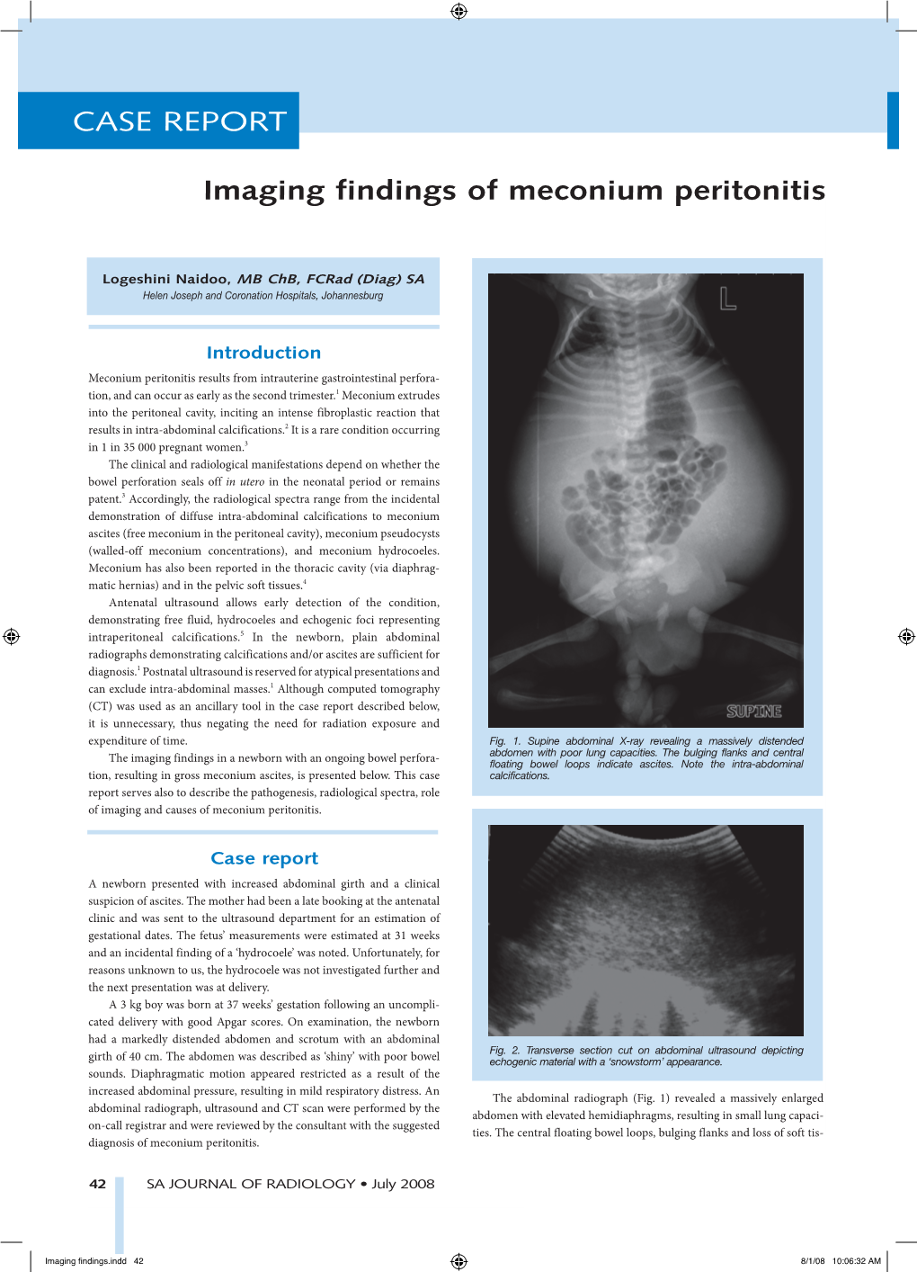 CASE REPORT CASE CASE R Imaging Findings of Meconium
