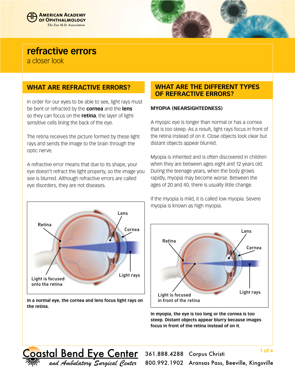 Refractive Errors a Closer Look