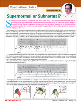 Supernormal Or Subnormal? Upernormal Conduction Is Not Actually Better Than Normal Conduction; It Is Only Better Than What Is Normally Expected