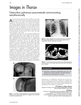 Images in Thorax