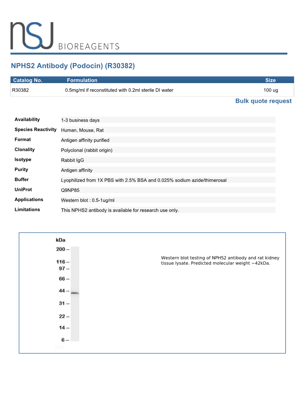 NPHS2 Antibody (Podocin) (R30382)