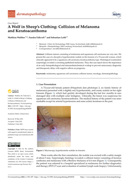 Collision of Melanoma and Keratoacanthoma