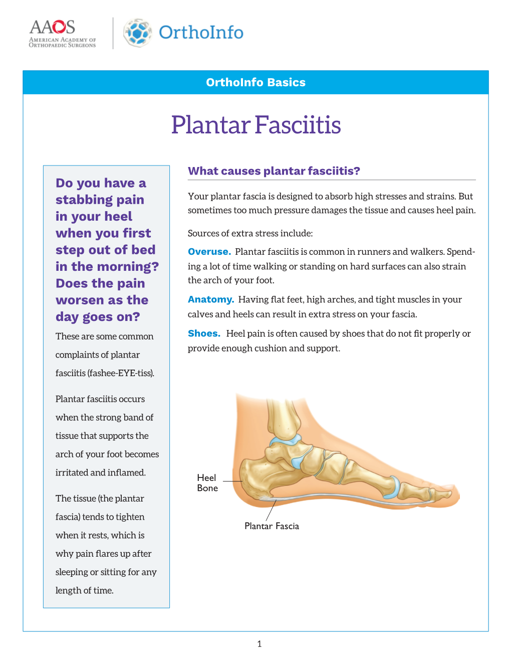 Plantar Fasciitis