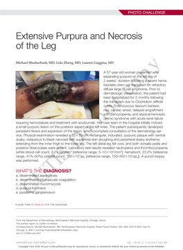 Extensive Purpura and Necrosis of the Leg