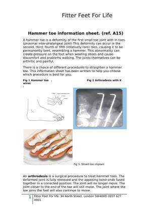Hammer Toe Information Sheet