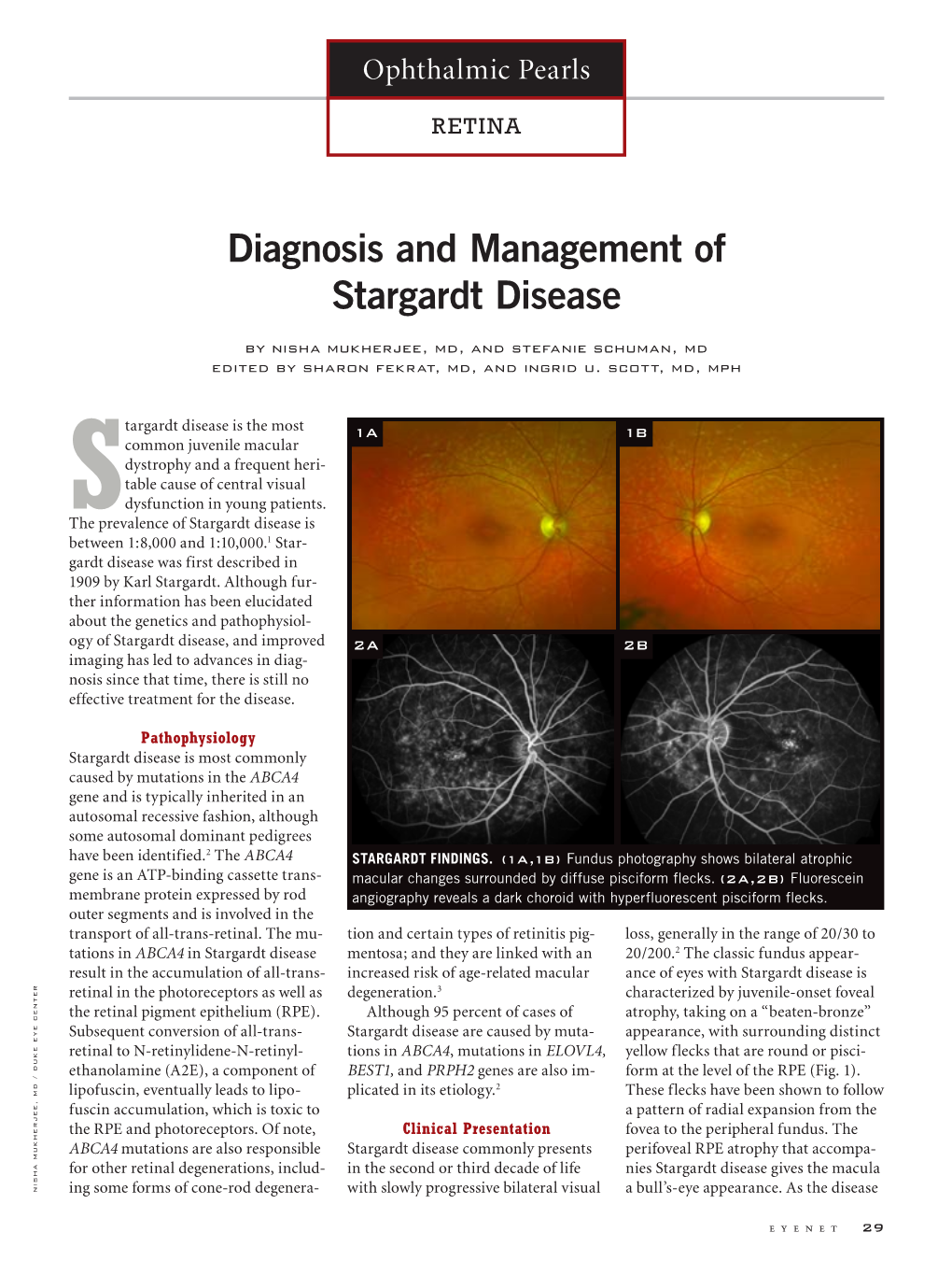 Diagnosis and Management of Stargardt Disease