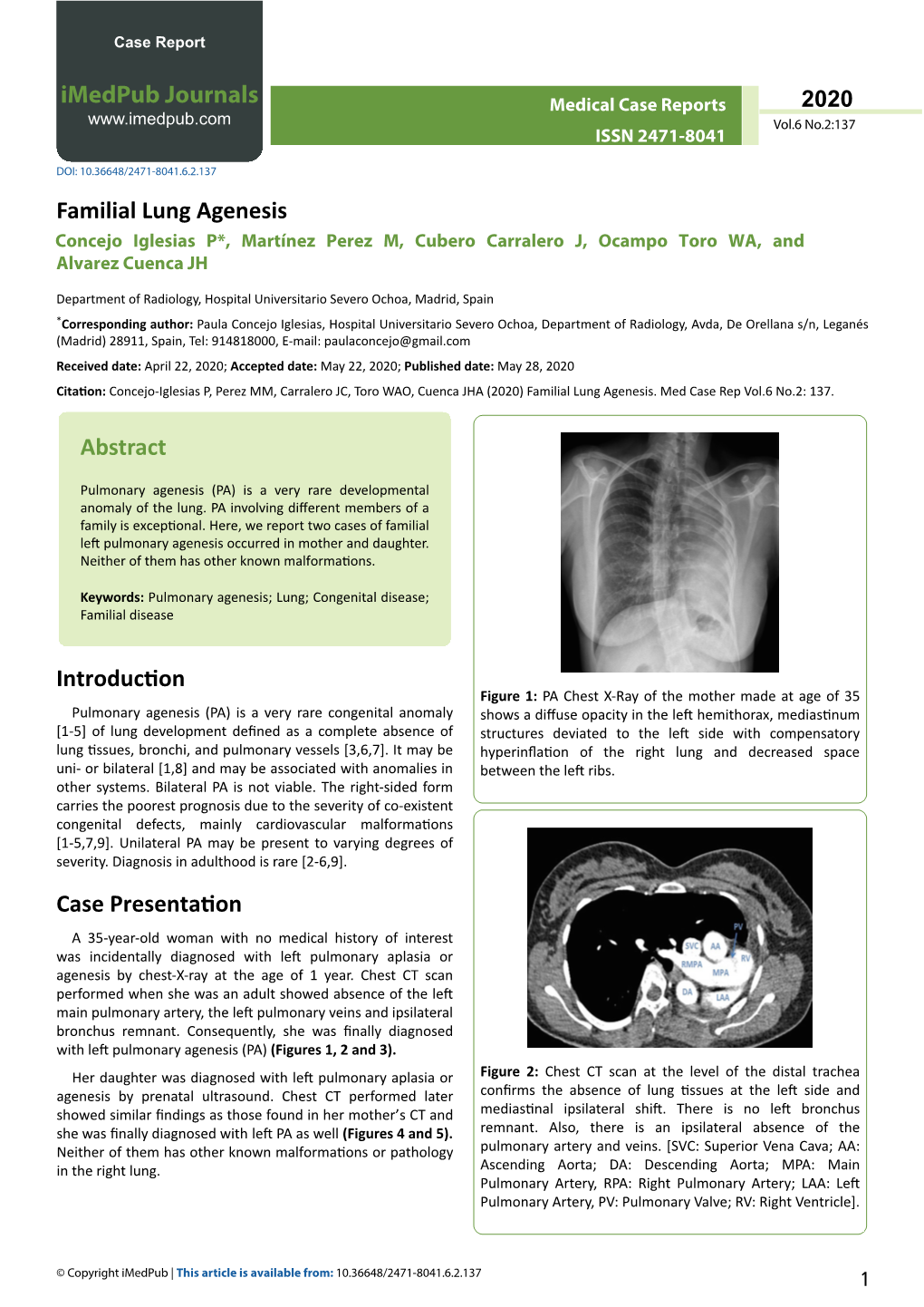 Familial Lung Agenesis Concejo Iglesias P*, Martínez Perez M, Cubero Carralero J, Ocampo Toro WA, and Alvarez Cuenca JH