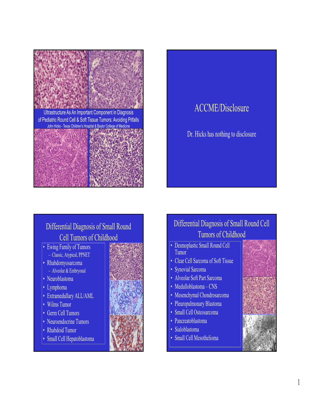 ACCME/Disclosure of Pediatric Round Cell & Soft Tissue Tumors: Avoiding Pitfalls John Hicks - Texas Children’S Hospital & Baylor College of Medicine Dr