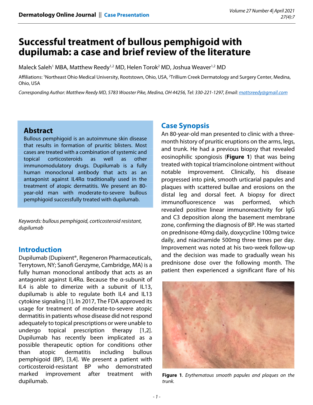 Successful Treatment Of Bullous Pemphigoid With Dupilumab A Case And Brief Review Of The 2168